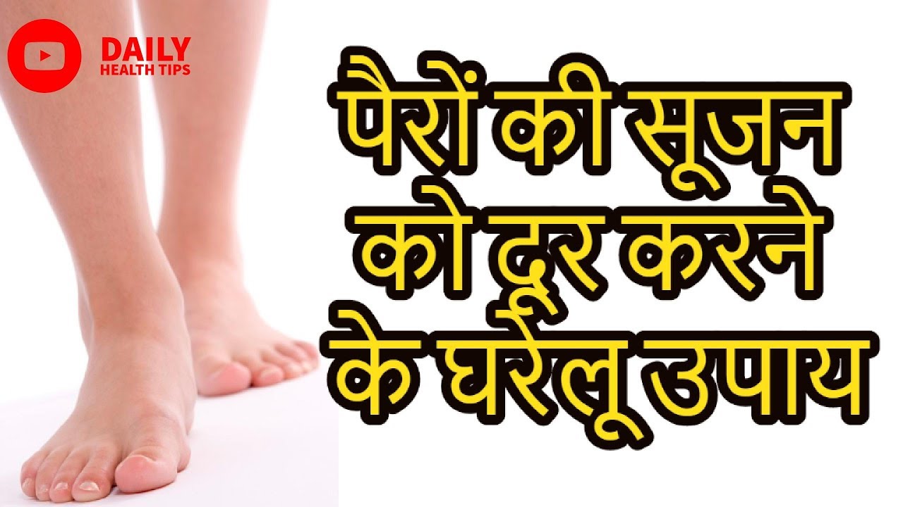 पैरो से सूजन दूर करने के आसान उपाय Home Remedy to Remove Swelling of