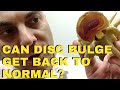 Can L4 L5 Disc Bulge Get Back To Normal Again? Does L5 S1 Disc Bulge Get Back To Normal Again?