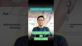 Chemo Port vs PICC Line | Cancer Treatment Devices Simplified