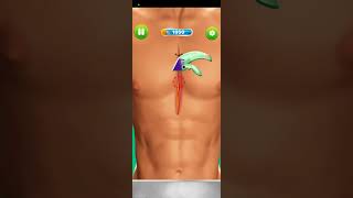 surgery doctor hospital || level 1 to 3 || doctor game || android gameplay screenshot 5