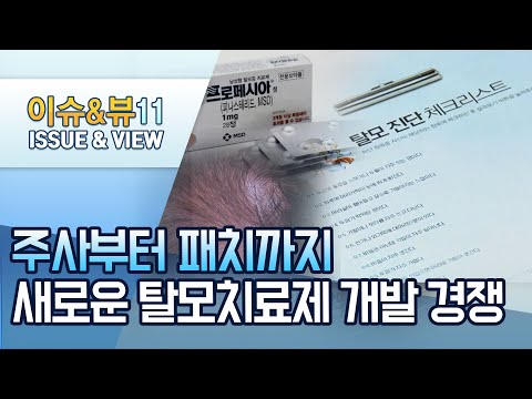 주사부터 패치까지…새로운 <strong>탈모</strong> <strong>치료제</strong> 개발 경쟁 / 머니투데이방송 (뉴스)