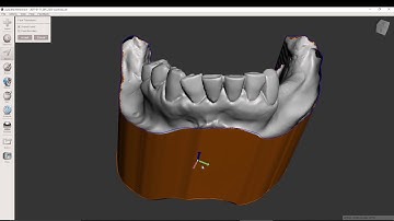 SCANNING IMPRESSON AND MODEL FABRICATION IN MESHMIXER