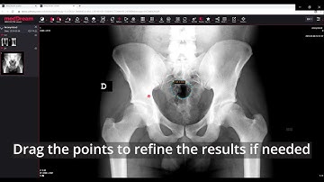 MedDream DICOM Viewer: measure the polyline