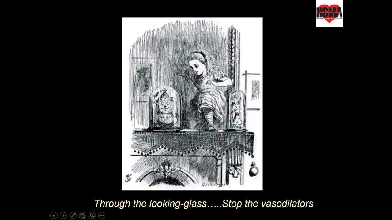 HCMA Webinar Series:  HCM and Norpace