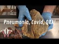Pneumonia, Covid, Q&A!