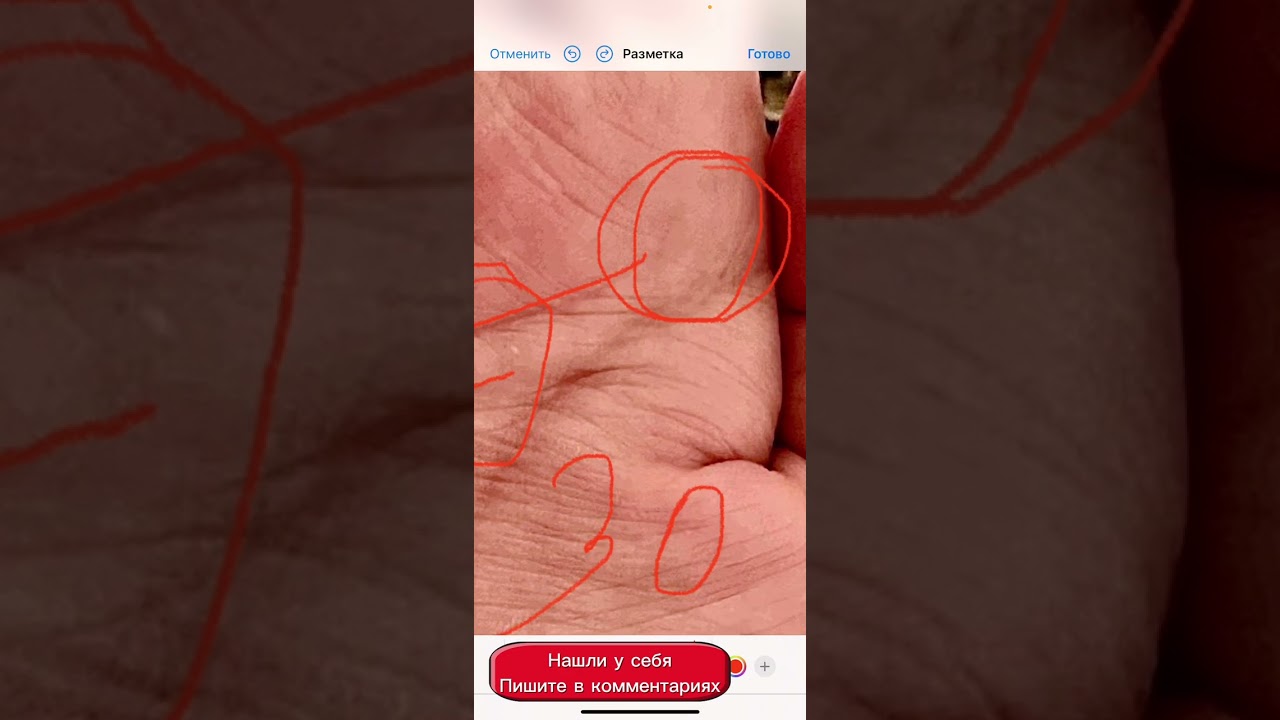 Опасные разрывы линии ума