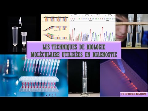 Les techniques de biologie moléculaire utilisées en diagnostic (1) : L&rsquo;EXTRACTION D&rsquo;ADN