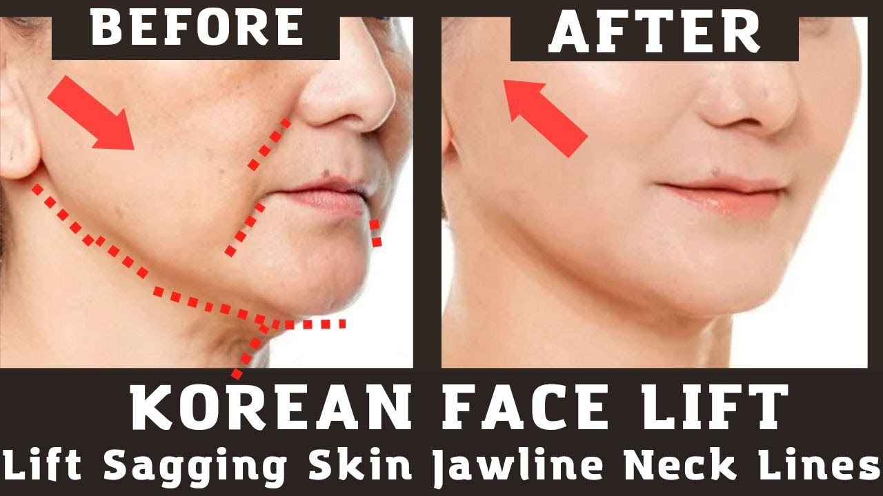 Korean face lift exercises Lift Sagging Skin Get Beautiful Jawline