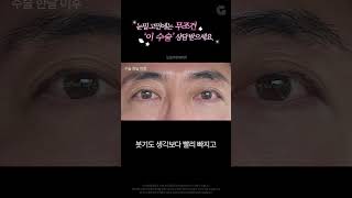 눈밑 고민에는 무조건 '이 수술' 상담 받으세요. #shorts