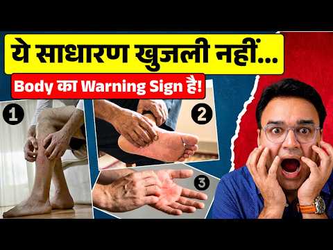 शरीर में इन ३ जगहों पर खुजली हो तो नज़अंदाज़ न करें - गंभीर बीमारी का संकेत है ये!
