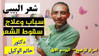 اسباب سقوط شعر البيبى - دكتور حاتم الوكيل - العناية بالشعر للاطفال