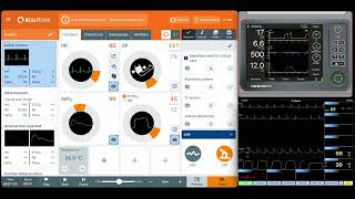 REALITi Version 11 video