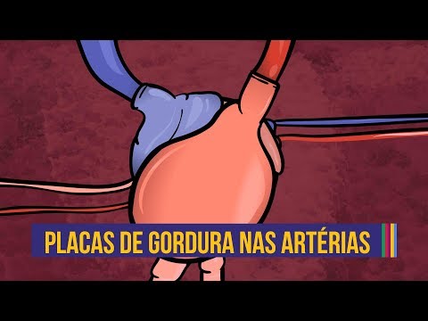 Vídeo: O resultado da redução do fluxo sanguíneo para o coração é causado pelo acúmulo de depósitos de gordura nas artérias?