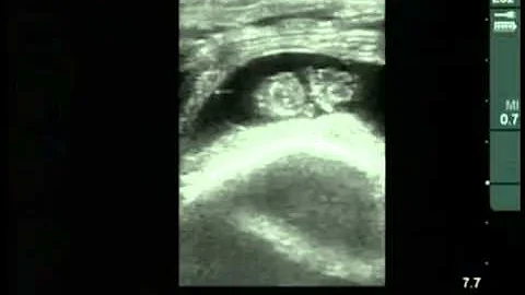 Cow #4539 Day 45 of Gestation