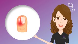 Wat Is Een Ingegroeide Teennagel? Symptomen, Oorzaken Behandeling Podotherapie Hermanns