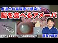日本でも報告 エボラ出血熱よりも致死率が高い 脳を食べるアメーバ 旅行の際には淡水に注意 医者が解説 日本でも報告 エボラ出血熱よりも致死率が高い 脳を食べるアメーバ 旅行の際には淡水に注意 医者が解説