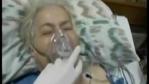 4.10. Chorea in Creutzfeld-Jakob Disease - Choreiform Disorders [Spring Video Atlas]