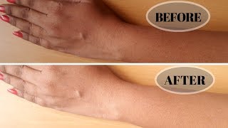 How To Remove Sun Tan Instantly from Face And Body | 100% works | Home Remedy