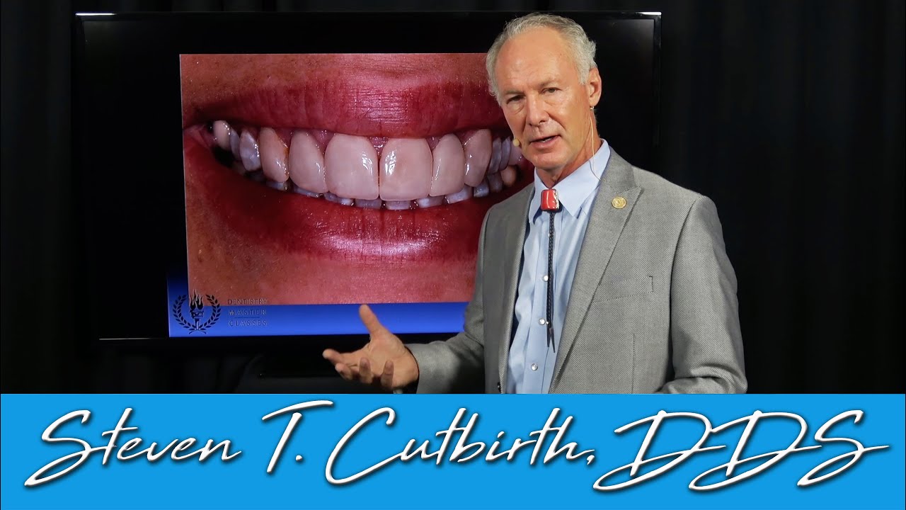Composites vs. Veneers - Dental Minute with Steven T. Cutbirth, DDS