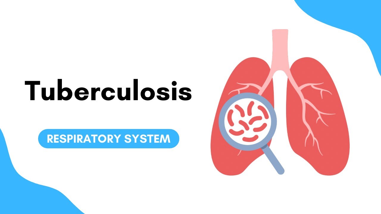 Tuberculosis - شرح بالعربي