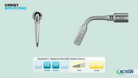 Crest splitting protocol 3D