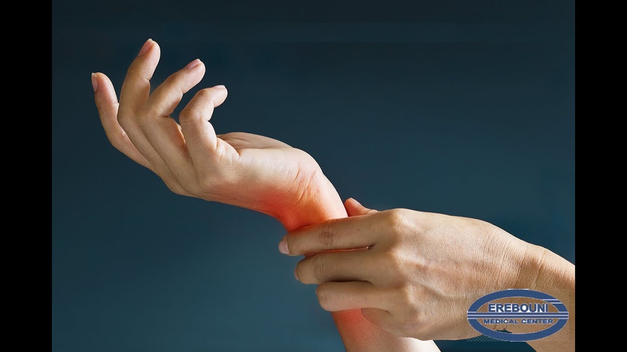 Դաստակի «թունելային» համախտանիշ