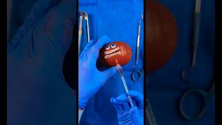 Emergency #Fruitsurgery! Moldy Tomato Gets Attacked In #Foodsurgery #Discountdentist #Satisfying
