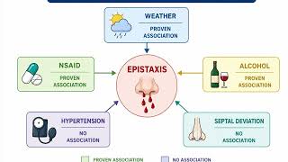EVIDENCE BASED -IDIOPATHIC EPISTAXIS 