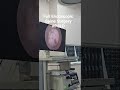 Full Endoscopic Spine Surgery #psld #drrahulprasad#yuvaanhospital#endoscopicspinesurgery