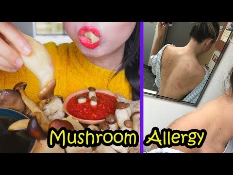 क्या आप मशरूम एलर्जी के बारे में सब कुछ (लक्षण और उपचार) जानते हैं?