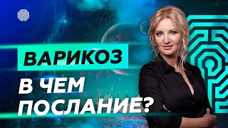 Варикоз! В чём послание?