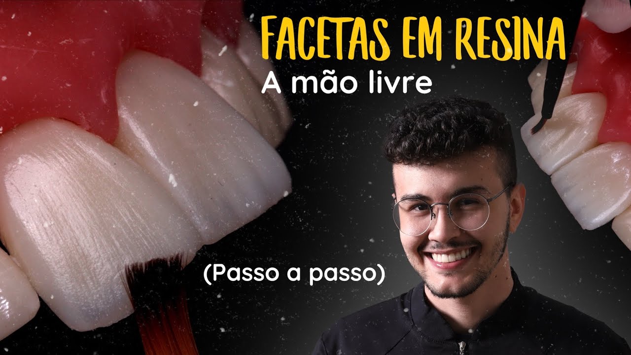 Tutorial Como Fazer a Camada de Esmalte de Facetas em Resina Composta a Mão Livre #2