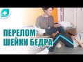 Перелом шейки бедра