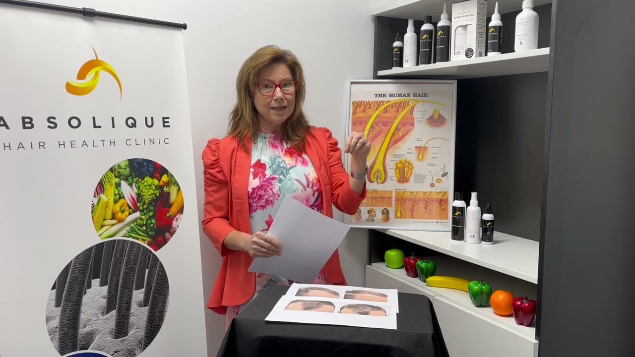 Mens hair loss vs male pattern baldness