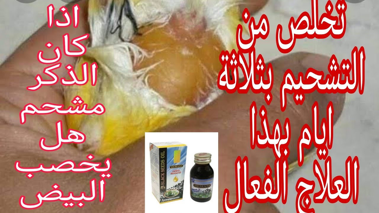 تخلص من التشحيم عند الكناري والحسون بثلاث ايام فقط (انواع التشحيم)