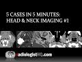 5 Cases in 5 Minutes: Head & Neck #1
