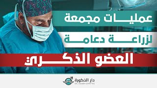 تركيب دعامة القضيب لعلاج الضعف الجنسي - عمليات مجمعة - الدكتور أسامة غطاس