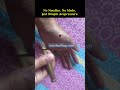 No Needles. No Meds. Just Simple Acupressure.