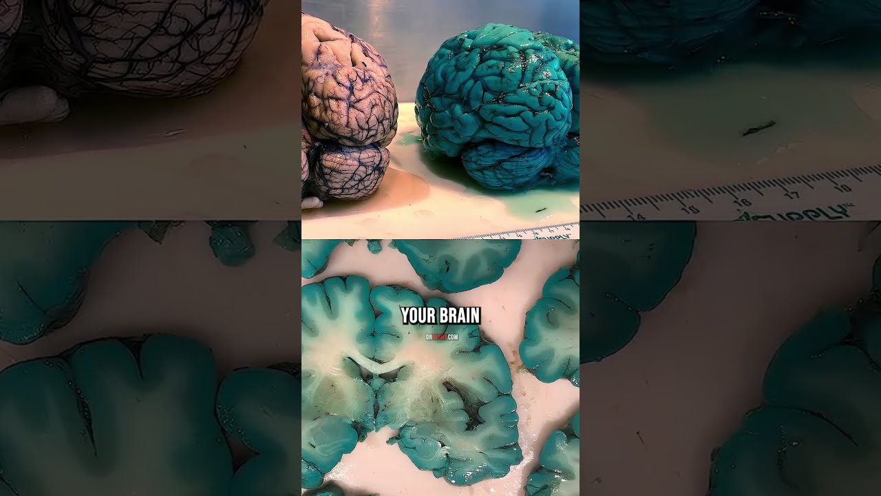 Methylene Blue Turns Your Brain BLUE 
