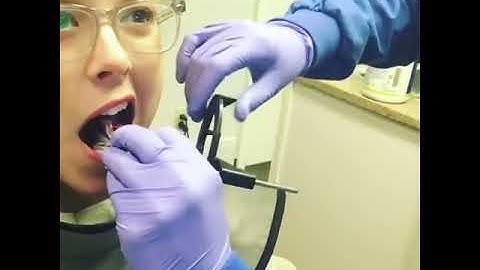 Dental digital x-ray images are EASY and FAST!  See what your dentist sees!