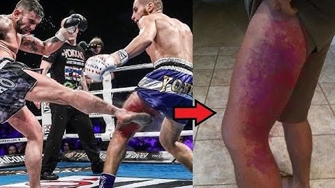 Crazy Pain... Most Brutal Low Kick KO's in Combat Sports #2