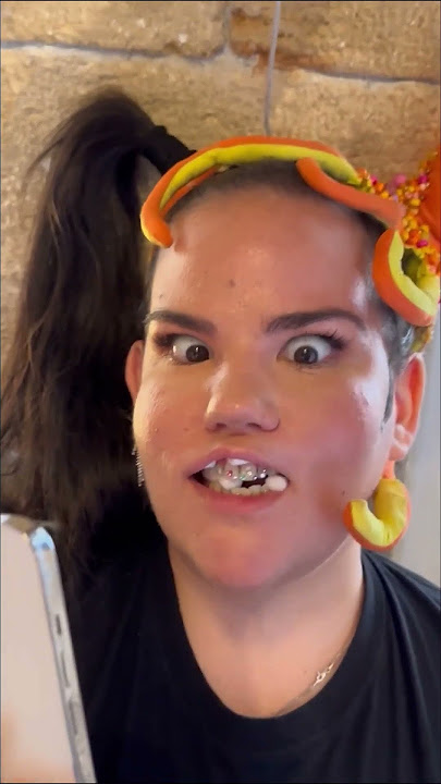 🦷💎🦷 Wonderful Dental blinggg