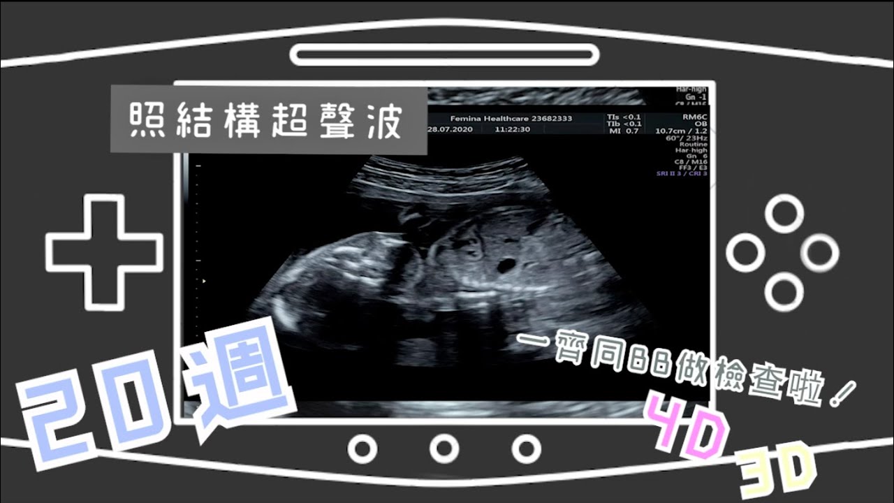 KOJI PREGNANCY 『我的懷孕日記』| 20週照結構啦！4D 3D 超聲波