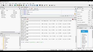 Optic Disc and Cup Segmentation Methods for Glaucoma Detection with Modification of U Net Convolutio