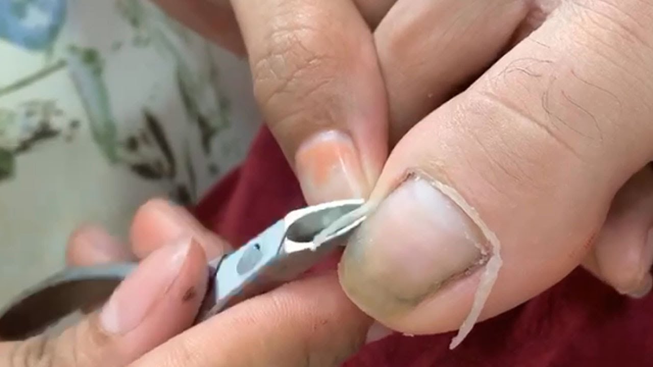 HOW TO CUT THICK TOENAILS Toenail Cleaning Satisfying 192 YouTube