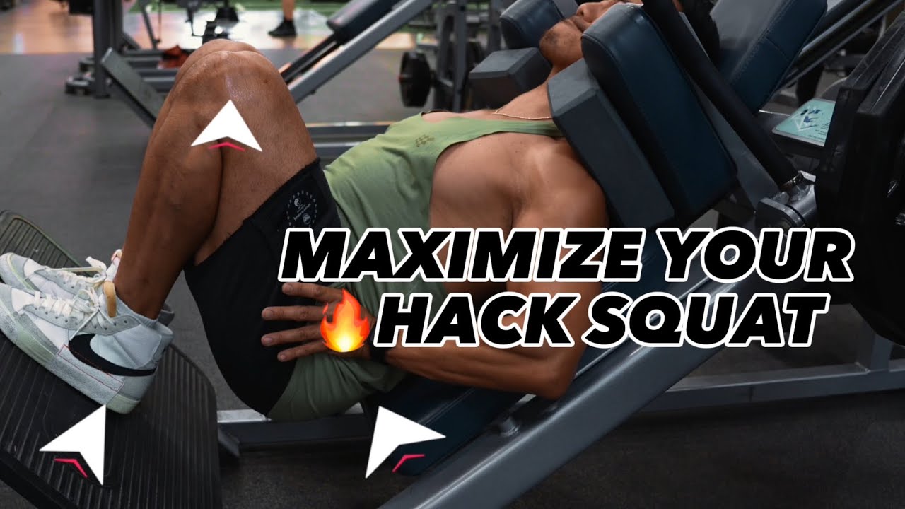 How to Perform a Hack Squat with an Inguinal Hernia and Keep it Reduced