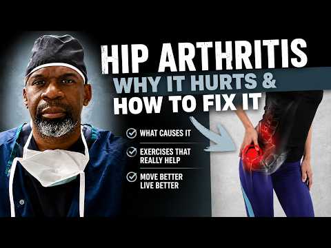 HIP OSTEOARTHRITIS: A Surgeon’s Guide to Pain, Causes and Exercises To Help