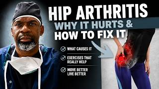 HIP OSTEOARTHRITIS: A Surgeon’s Guide to Pain, Causes and Exercises To Help