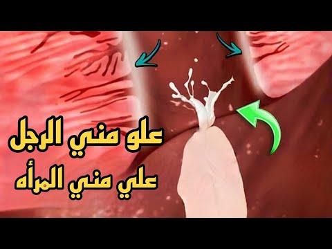 فيديو: هل يحتوي الوتدي على سيلا تورسيكا؟