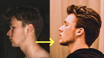 Wie lange dauert es bis man eine Jawline bekommt?